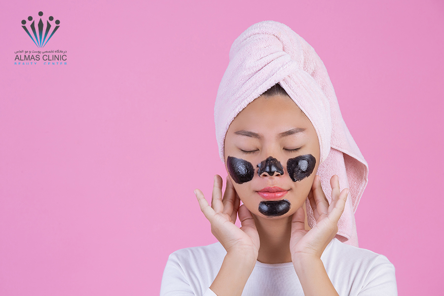 درمان جوش های سرسیاه