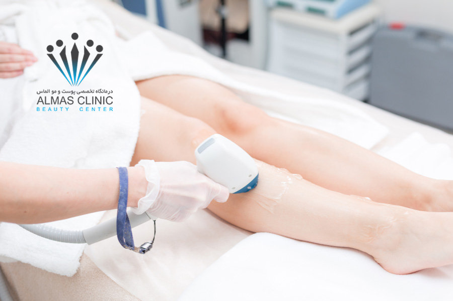 لیزر موهای زائد