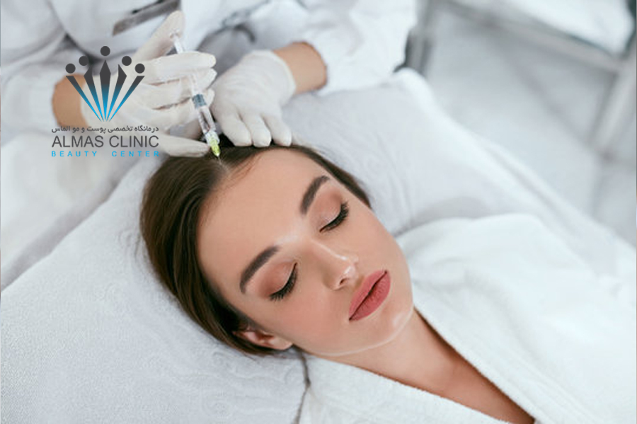 مزوتراپی مو