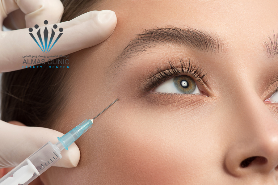 فیلرها و جوانی پوست