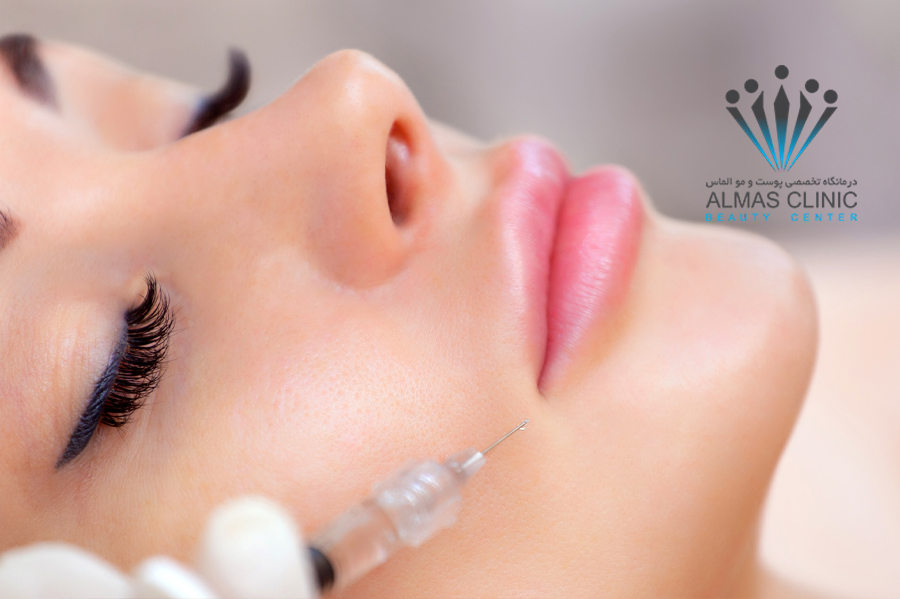 فیلرها و جوانی پوست