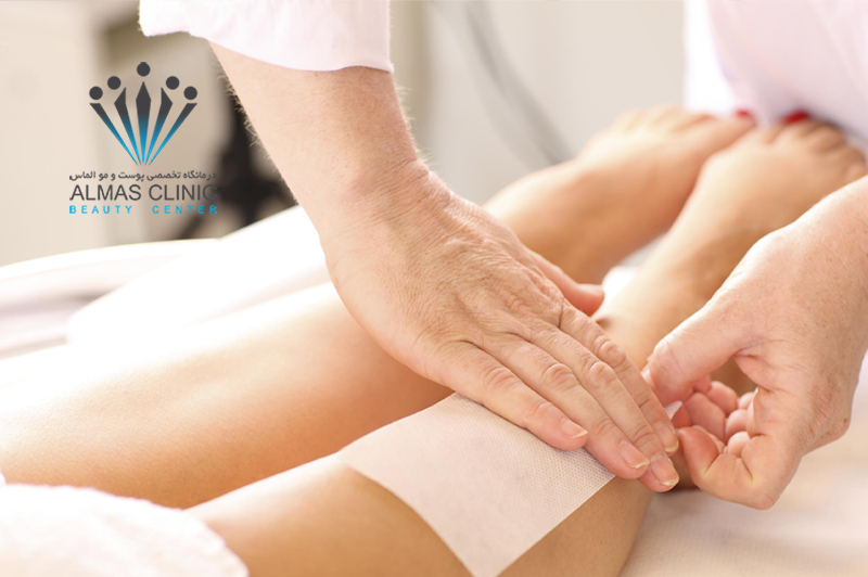 بهترین زمان لیزر