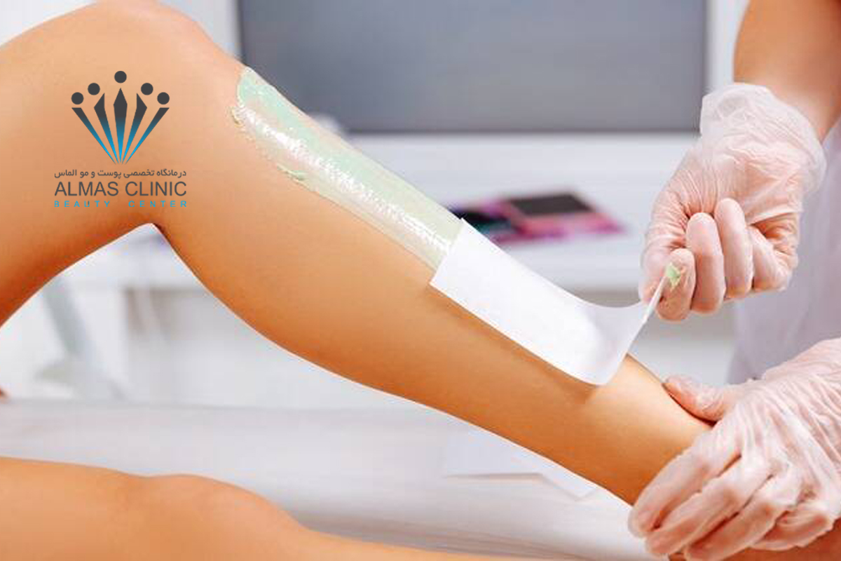 آمادگی های قبل از انجام لیزر درمانی