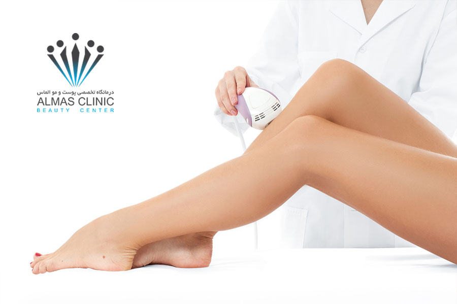 لیزر موهای زائد