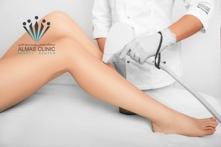 لیزر موهای زائد