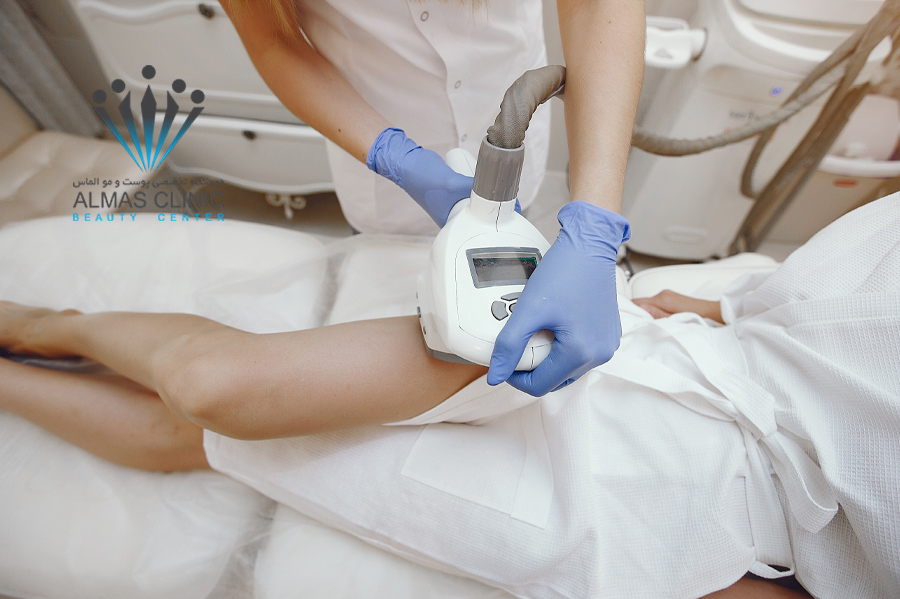 اپیلاسیون یا لیزر