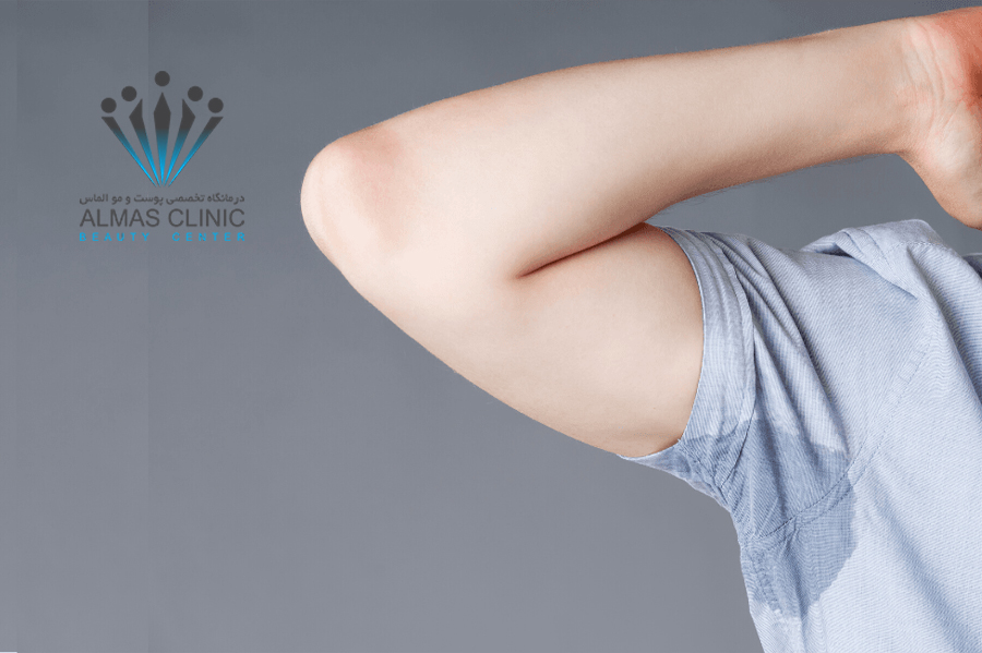 بوتاکس زیر بغل
