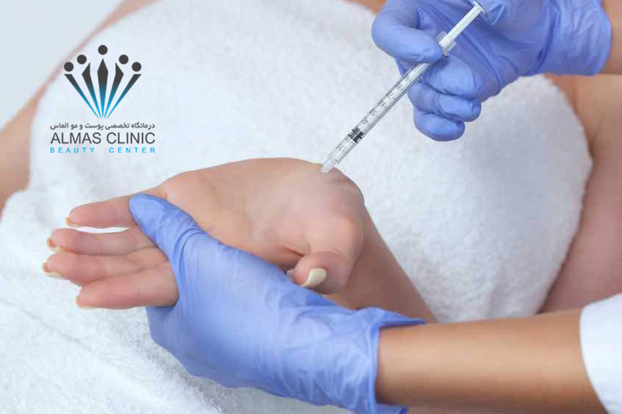 بوتاکس زیر بغل