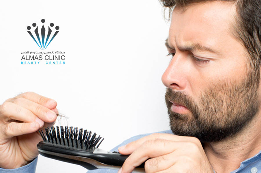 کاشت مو در افراد دیابتی