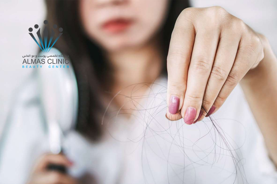 ریزش و در زنان حامله