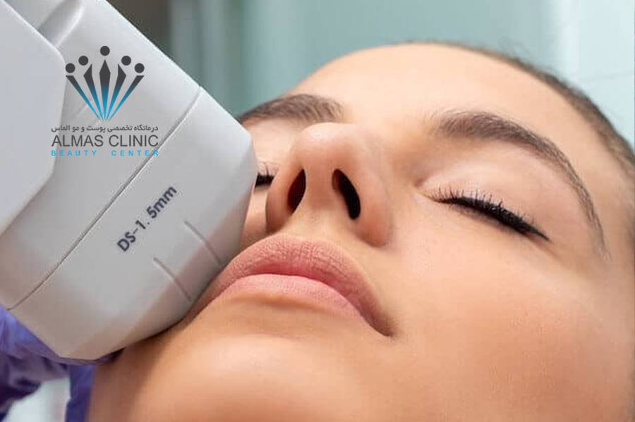 لیفت و جوانسازی صورت