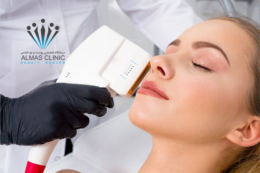 لیفت صورت با هایفوتراپی