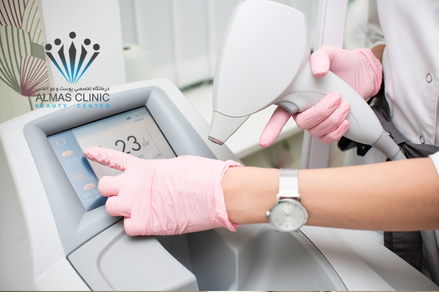 لیزر موهای زائد