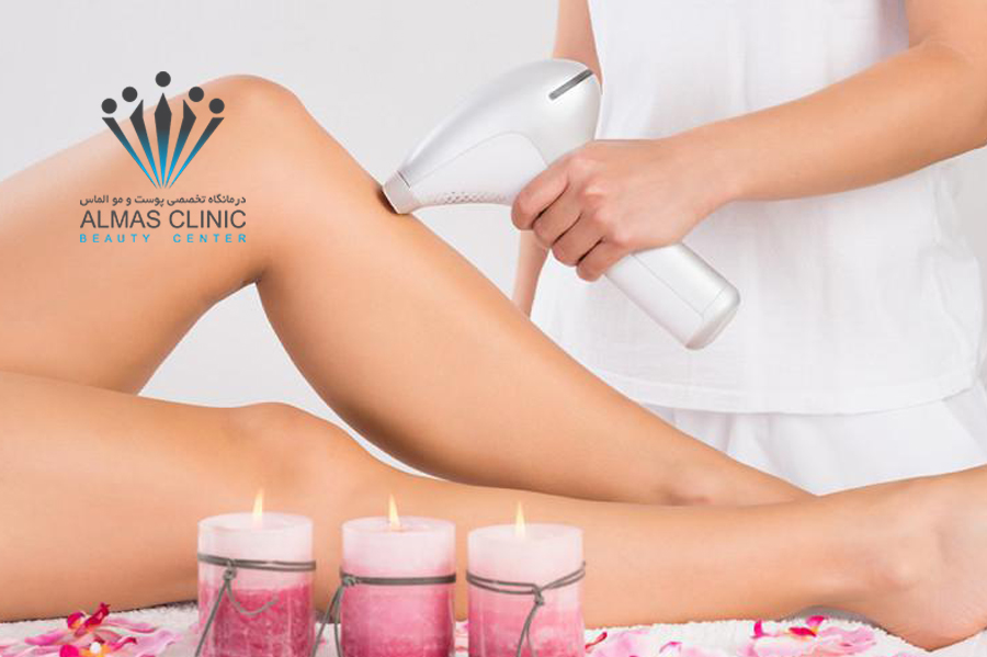 لیزر موهای زائد