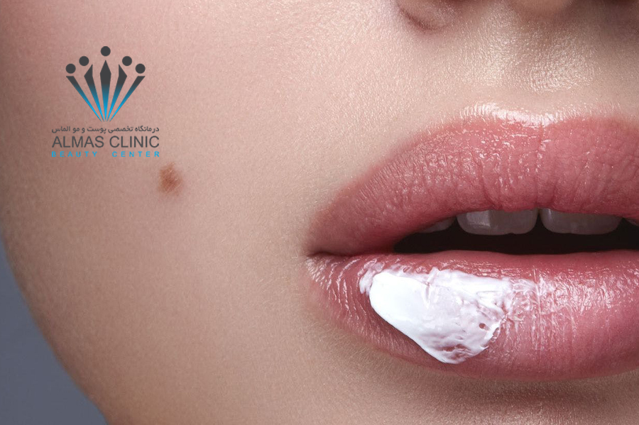 خشکی لب