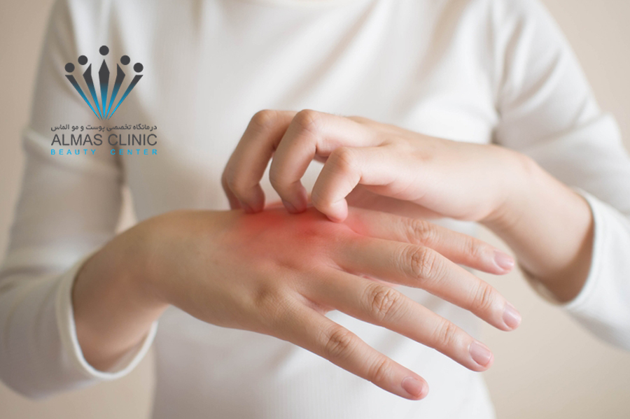 مراقبت از پوست در زمستان