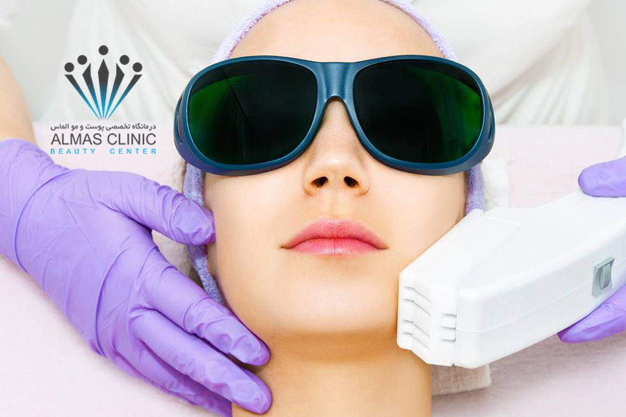 لیزر فرکشنال