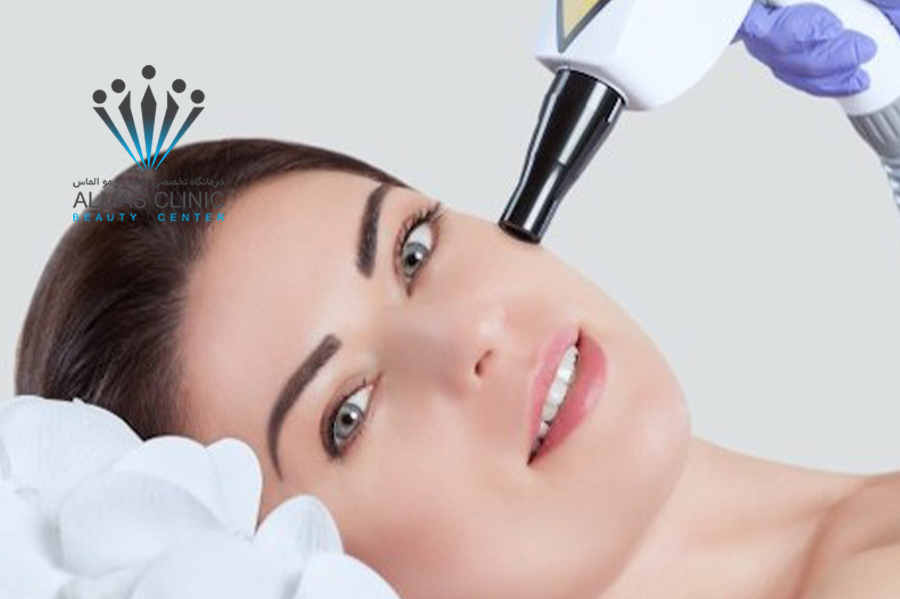 لیزر فرکشنال