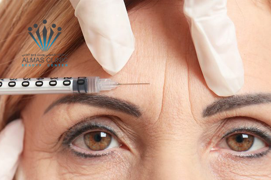 تزریق بوتاکس