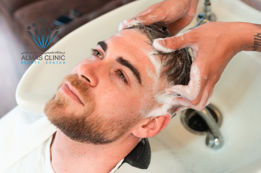 شستشوی موها بعد از کاشت مو