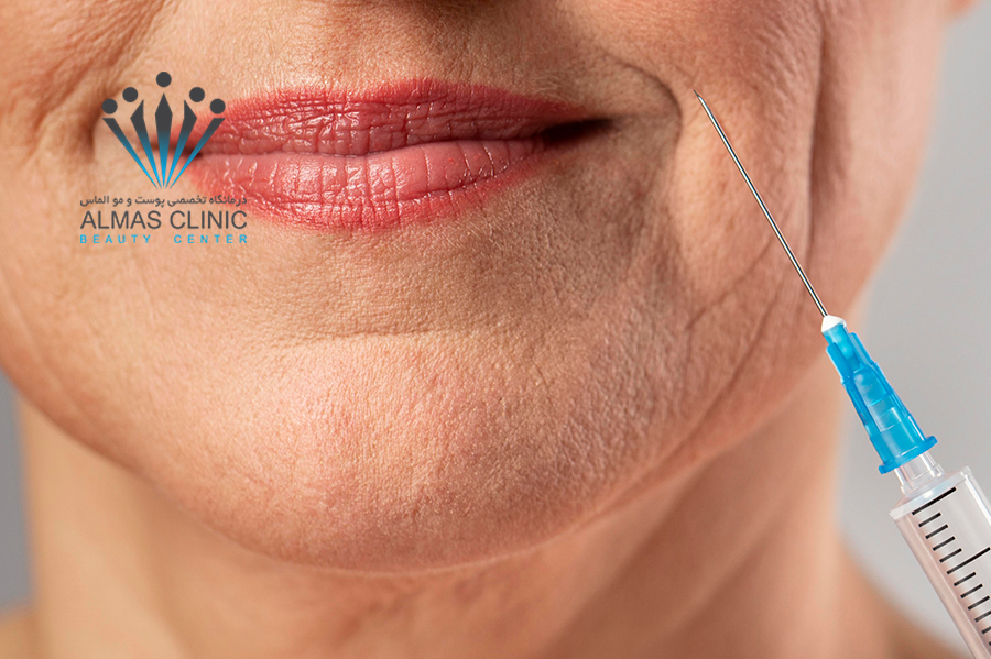 هایفو یا بوتاکس