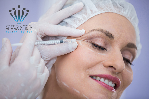 چه افرادی مناسب بوتاکس هستند؟