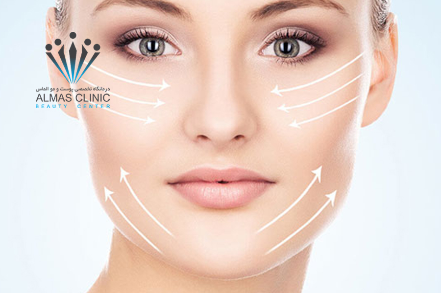 انجام زاویه سازی صورت