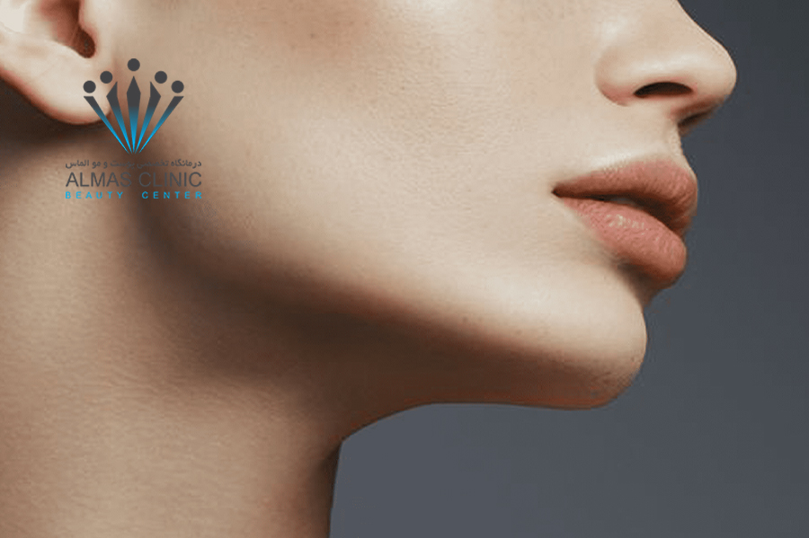 زاویه سازی فک