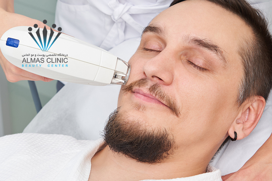 لیزر موهای زائد آقایان