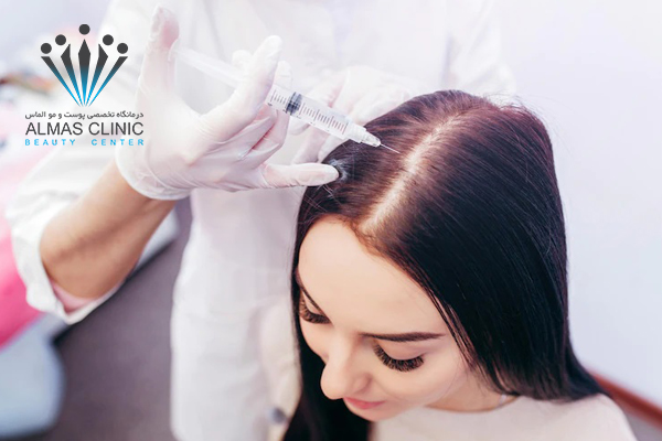 چرا باید از فیلر مو استفاده کنیم؟