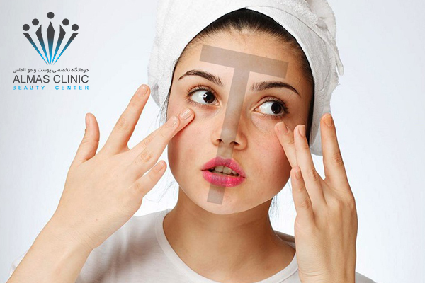 علت بروز پوست مختلط چیست؟ 