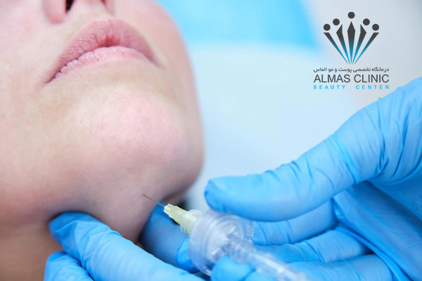 غبغب و علت به وجود آمدن آن