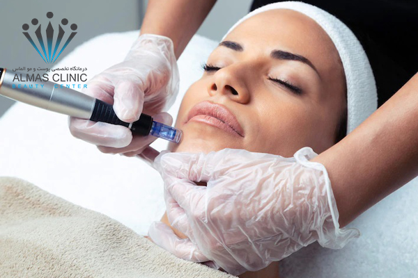 مزونیدلینگ برای درمان چه آسیبهایی استفاده میشود؟