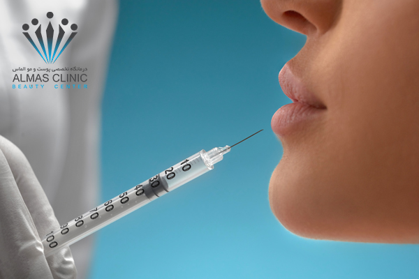 تزریق ژل پروفایلو چیست؟
